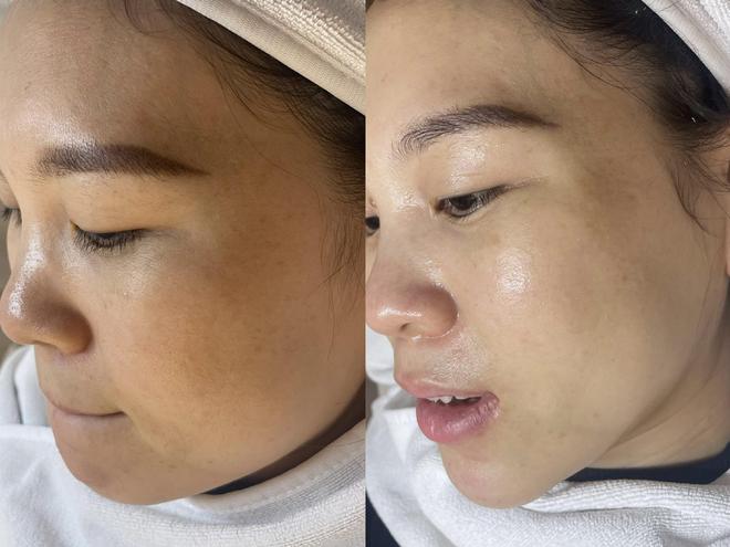 好用 超补水？看完本篇分享你就懂了凯发K8登录入口补水面膜哪个牌子的(图7)